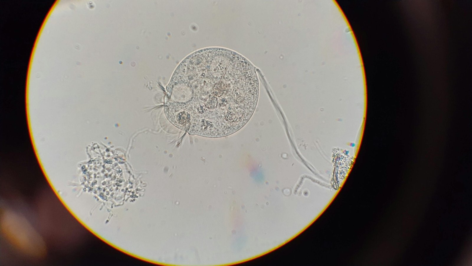 What Are Protozoa And How Do They Enter Wells? What Are Protozoa And How Do They Enter Wells?